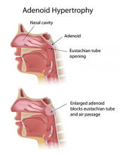 What are the adenoids?