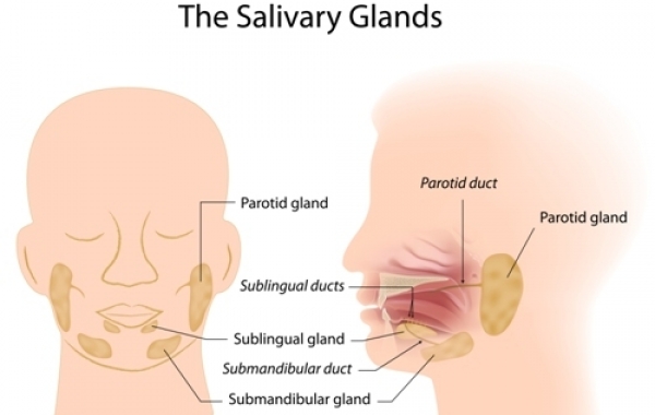 Salivary Gland Disease