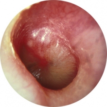 What types of conditions can occur in the middle ear?